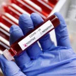 रतलाम में एक और कोरोना पॉजिटिव की पुष्टि