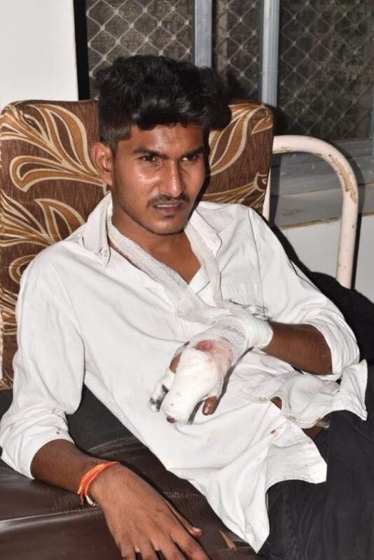 सतना : सड़क पर बेखौफ गुंडों का तांडव, सरेआम युवक की पिटाई- गोली चली